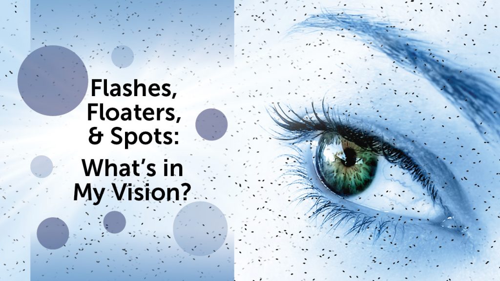 Flashes, Floaters, and Spots: What’s in my Vision?